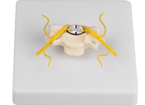 https://mail.jayakelana.id/uploads/product/-4067-vertebra-with-spinal-952539f2afe432b_cover.jpg