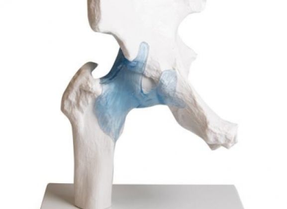 https://mail.jayakelana.id/uploads/product/-4553-hip-joint-with-82763c414e2056d_cover.jpg