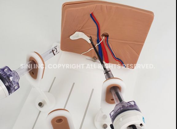 https://mail.jayakelana.id/uploads/product/-a-lph-01-laparoscopic-hernia-surgery-7117416c2979294_cover.jpg