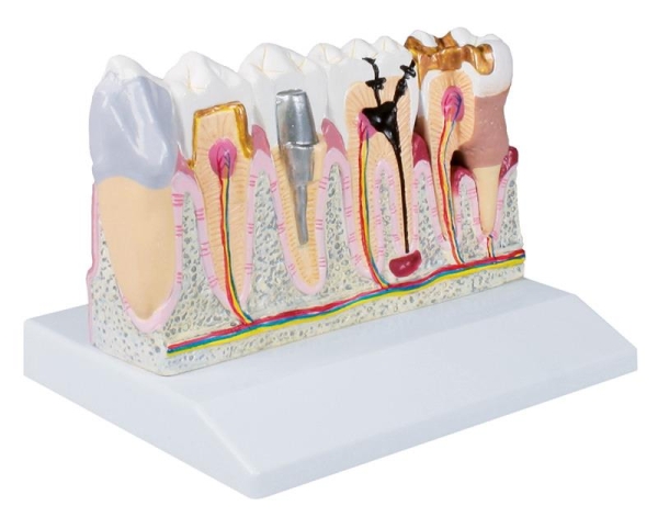 (D250) Dental Model, 4 times life size - EZ Augmented Anatomy