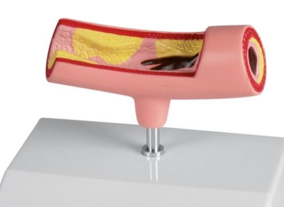 https://mail.jayakelana.id/uploads/product/-g241-artery-model-772495449e734f5_cover.jpg