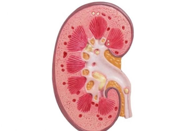 https://mail.jayakelana.id/uploads/product/-k229-kidney-stone-model-18398e383d2b92e_cover.jpg