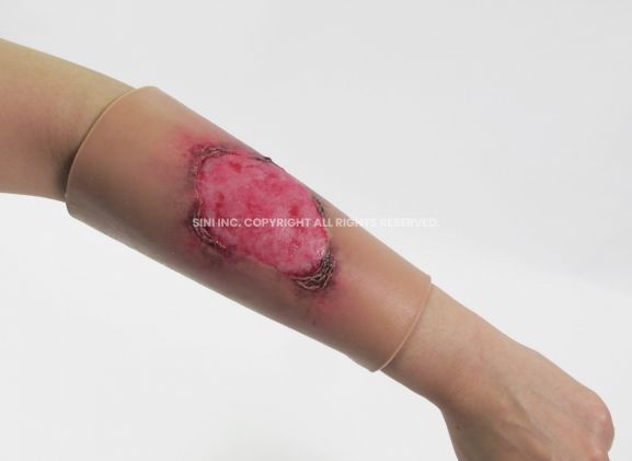 https://mail.jayakelana.id/uploads/product/-l-bur-01-burn-treatment-model-30229ee7a54c9c5_cover.jpg