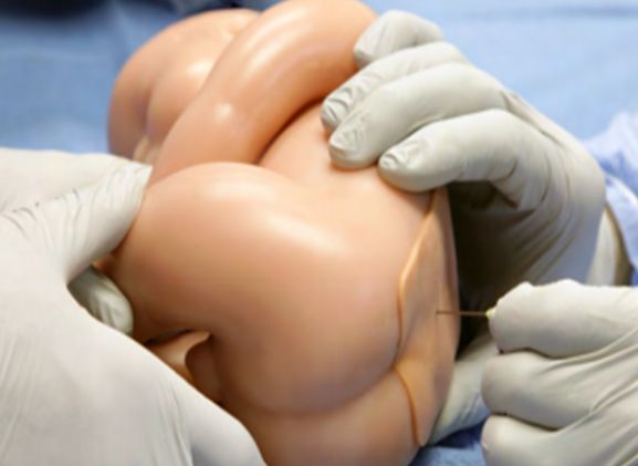 https://mail.jayakelana.id/uploads/product/-lpb-40-lumbar-puncture-baby-752626142266041_cover.png
