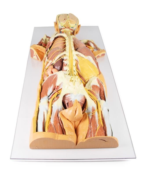 (MP1400) Nervous System Dissection (posterior view)