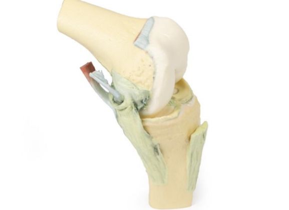 https://mail.jayakelana.id/uploads/product/-mp1800-knee-joint-flexed-89418a7b40730c5_cover.jpg