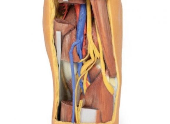 https://mail.jayakelana.id/uploads/product/-mp1820-popliteal-fossa-distal-7454066ff46504e_cover.jpg
