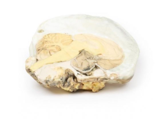 https://mail.jayakelana.id/uploads/product/-mp2006-pituitary-adenoma-24584e7d9ff5b59_cover.jpg