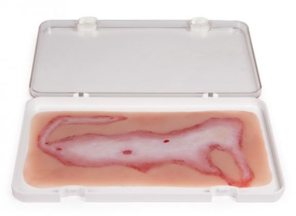 https://mail.jayakelana.id/uploads/product/-nw108-wound-moulage-scalding-878556fa9e7b542_cover.jpg