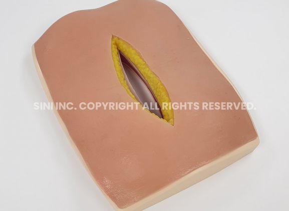 https://mail.jayakelana.id/uploads/product/-s-afs-01-abdominal-fascia-suture-968431c7eb30eca_cover.jpg