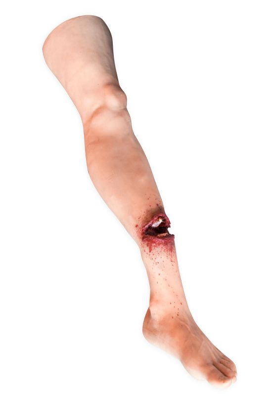 (X1301) Leg with Open Fracture Task Trainer