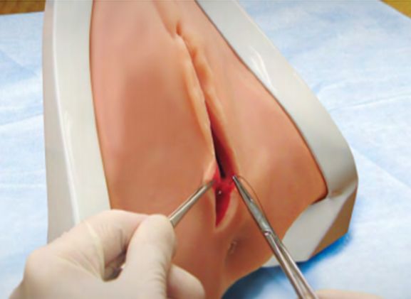 https://mail.jayakelana.id/uploads/product/pelatih-perineal-perineal-prt-20--41963e3954c122f_cover.png