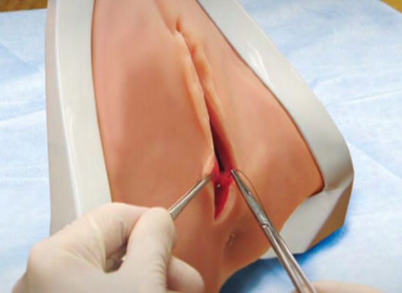 https://mail.jayakelana.id/uploads/product/perineal-repair-replaceable-tissue-12948e3954c122f_cover.png