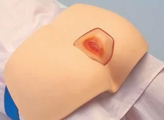 https://mail.jayakelana.id/uploads/product/simulator-pengobatan-decubitus-m156--123164a81d274ef_cover.png