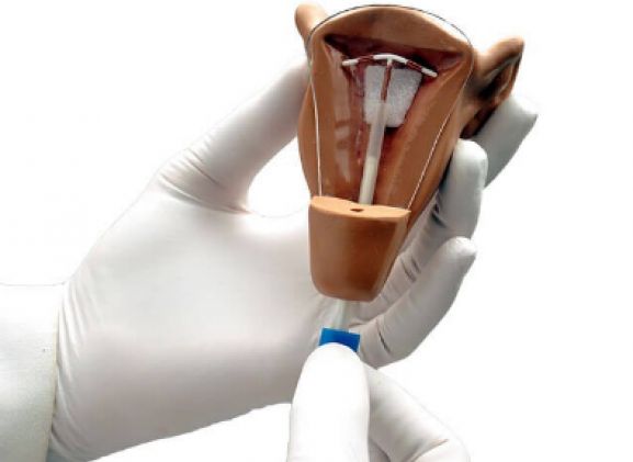 https://mail.jayakelana.id/uploads/product/uterus-i-iud-placement-64463ffb81dc10c_cover.png